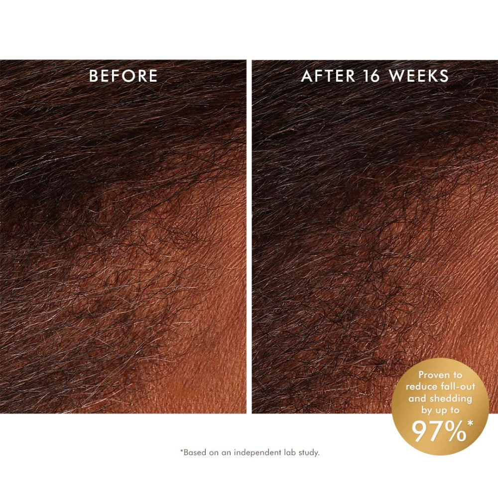 Moroccanoil Revitalizing Scalp Tonic 100ml