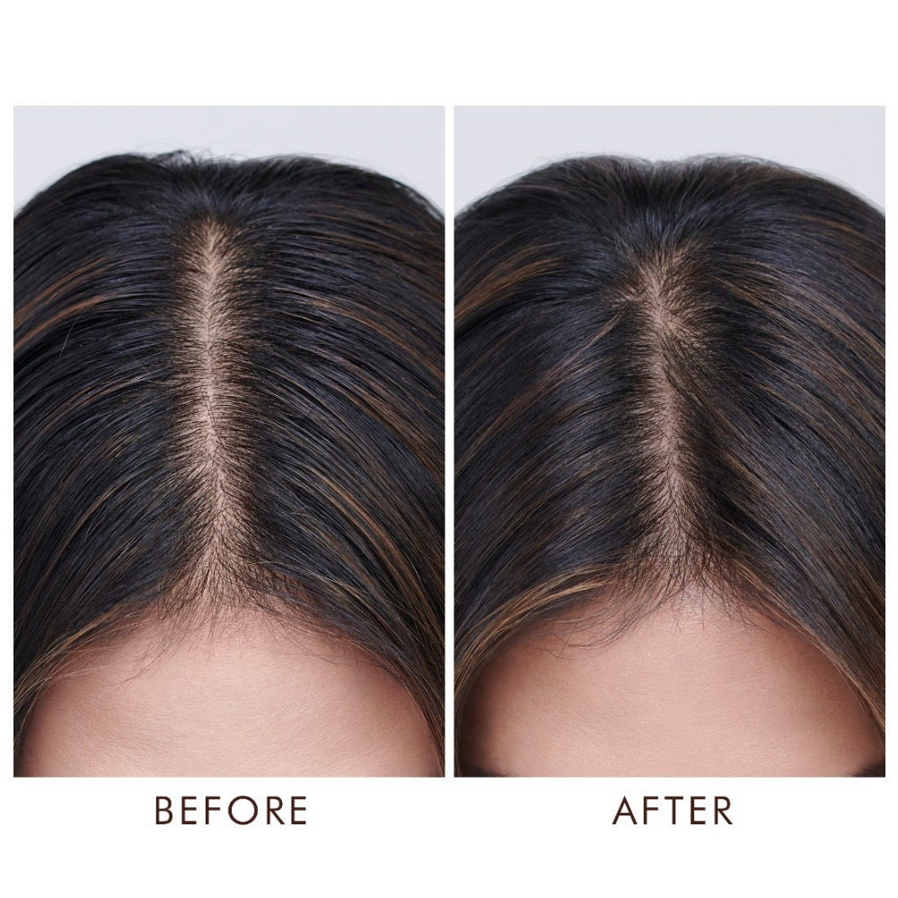 Moroccanoil Oily Scalp Treatment 45ml